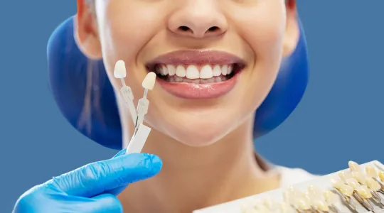 Dental Veneers at Highlandtown Dental Group in Baltimore, Maryland